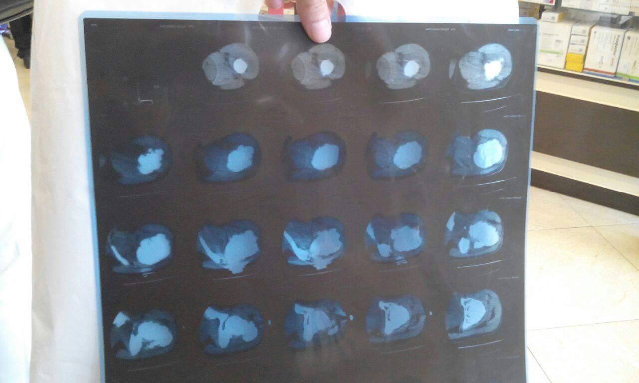 Молодому отцу нужна срочная медицинская помощь 6 14087411_1011050625660675_596352788_o