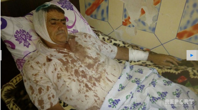 На животном рынке в Имишли избили отца с тремя сыновьями