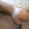 cigir-acan-yontem-eli-midesine-dikildi-9184453
