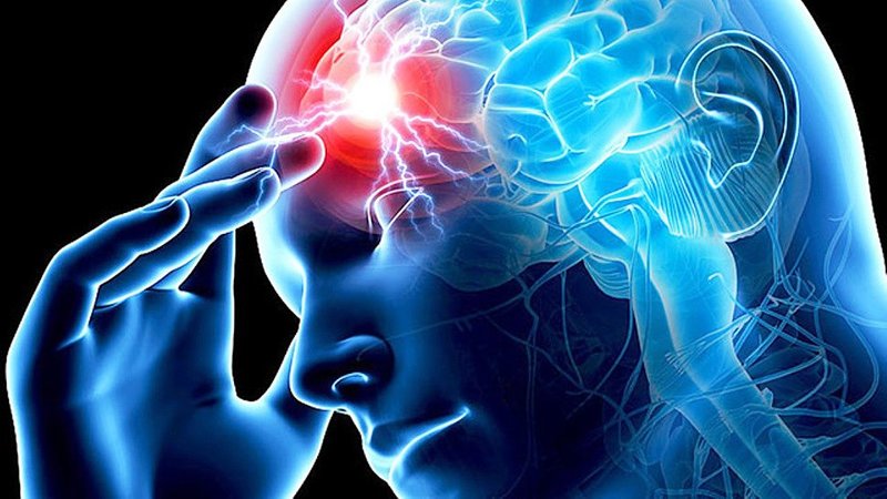 Создан прибор, выявляющий инсульт с точностью 92%