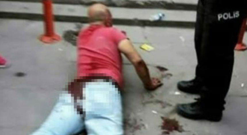 Отец пытался кастрировать пристававшего к его дочери мужчину в Анкаре