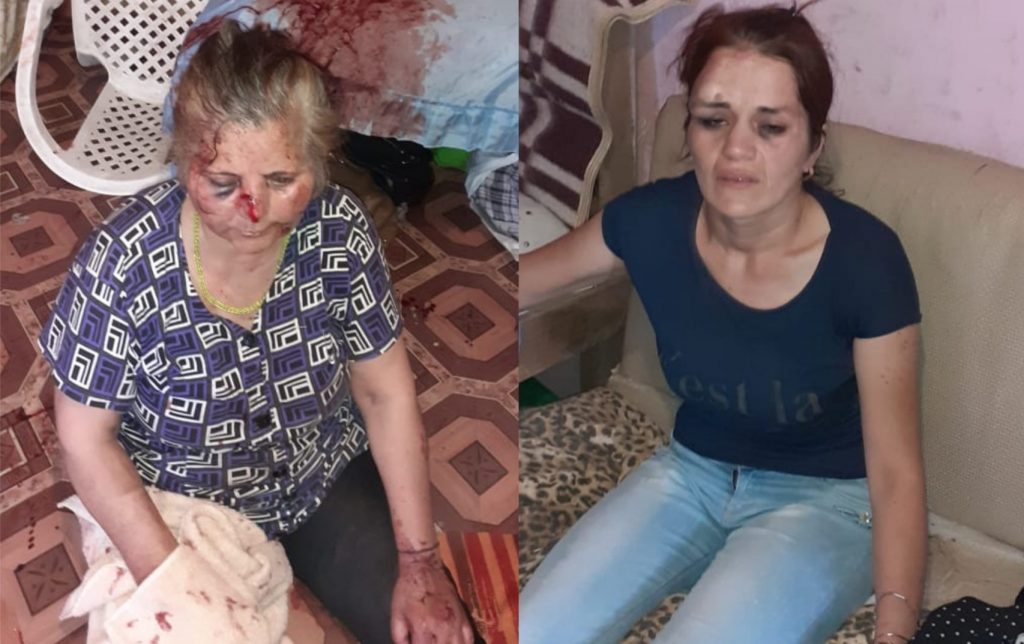 В Баку квартирант зверски избил жену и тещу