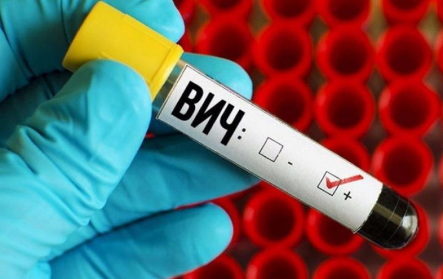 Ученые обнаружили новый штамм ВИЧ