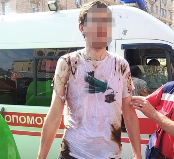 Житель Киева пытался совершить самосожжение во время парада