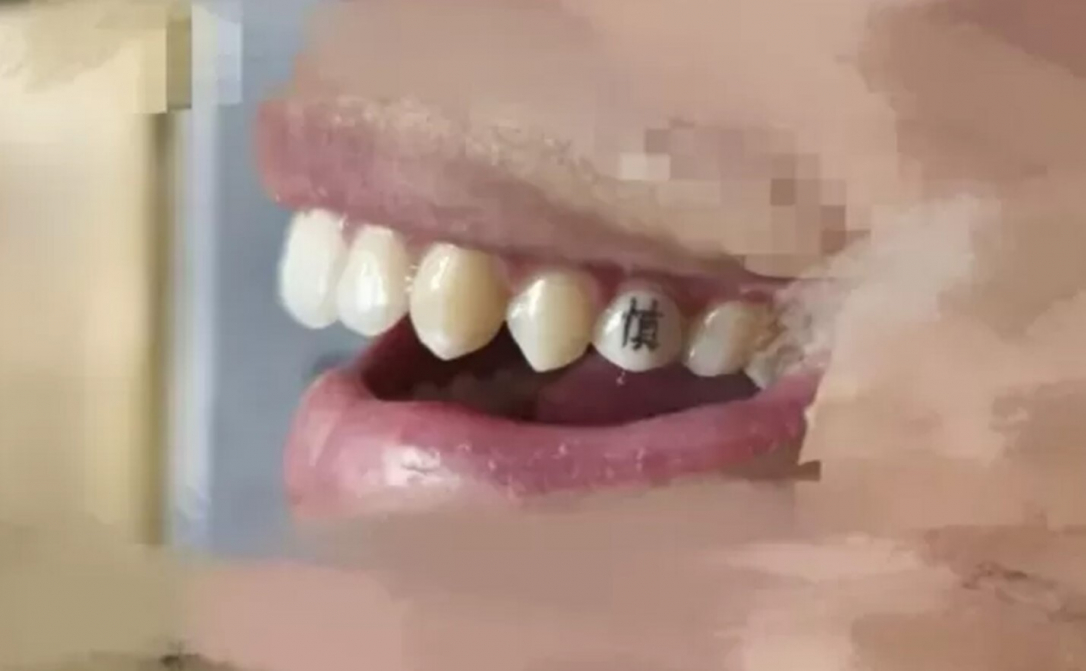 Зубные татуировки — новый способ самовыражения в Китае