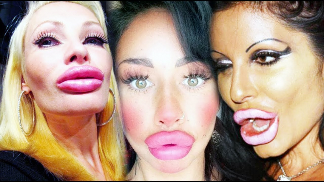 Лица, перенесшие пластические операции, столкнутся с проблемами