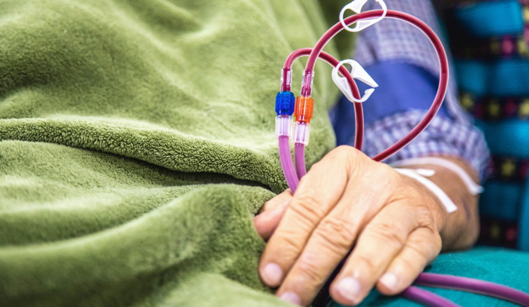 Диализная помощь в Азербайджане станет еще доступнее