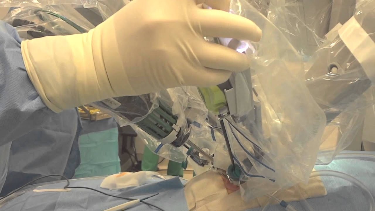 Первая в Азербайджане роботизированная операция реализована в бакинской клинике