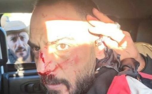 В Сирии задержали палача времён Асада